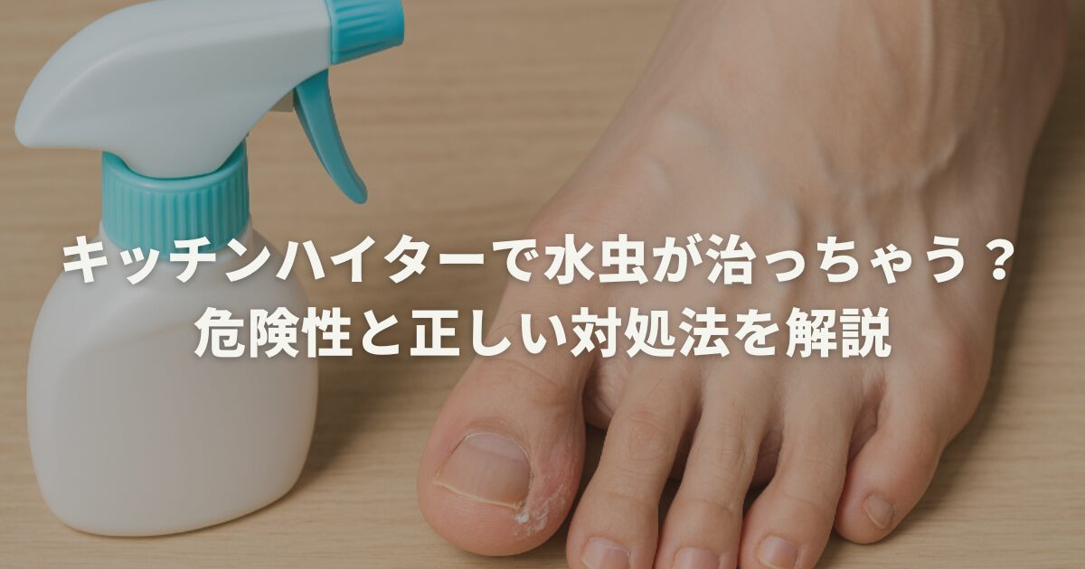 キッチンハイターで水虫が治っちゃう？危険性と正しい対処法を解説
